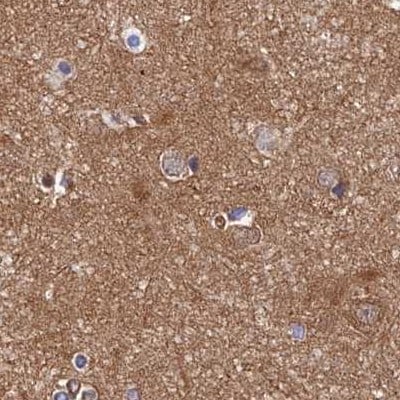 Dynactin Subunit 2/DCTN2/DCTN-50 Antibody - BSA Free Immunohistochemistry-Paraffin: Dynactin Subunit 2/DCTN2/DCTN-50 Antibody [NBP1-85278]