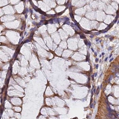 Dynactin Subunit 2/DCTN2/DCTN-50 Antibody - BSA Free Immunohistochemistry-Paraffin: Dynactin Subunit 2/DCTN2/DCTN-50 Antibody [NBP1-85278]