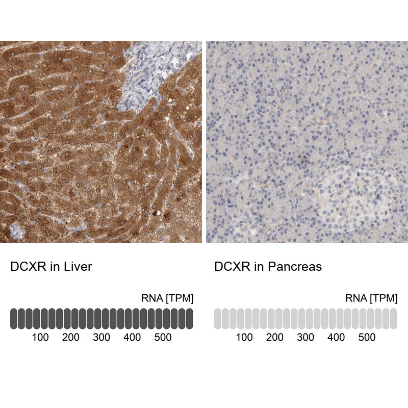 DCXR Antibody - BSA Free Immunohistochemistry-Paraffin: DCXR Antibody [NBP1-85279]