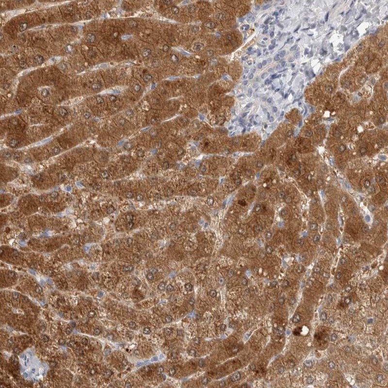 DCXR Antibody - BSA Free Immunohistochemistry-Paraffin: DCXR Antibody [NBP1-85279]