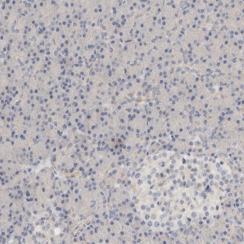 DCXR Antibody - BSA Free Immunohistochemistry-Paraffin: DCXR Antibody [NBP1-85279]
