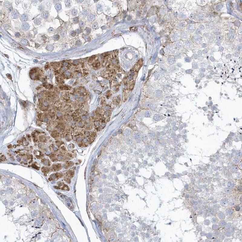 VprBP Antibody - BSA Free Immunohistochemistry: VprBP Antibody - BSA Free [NBP1-85284]