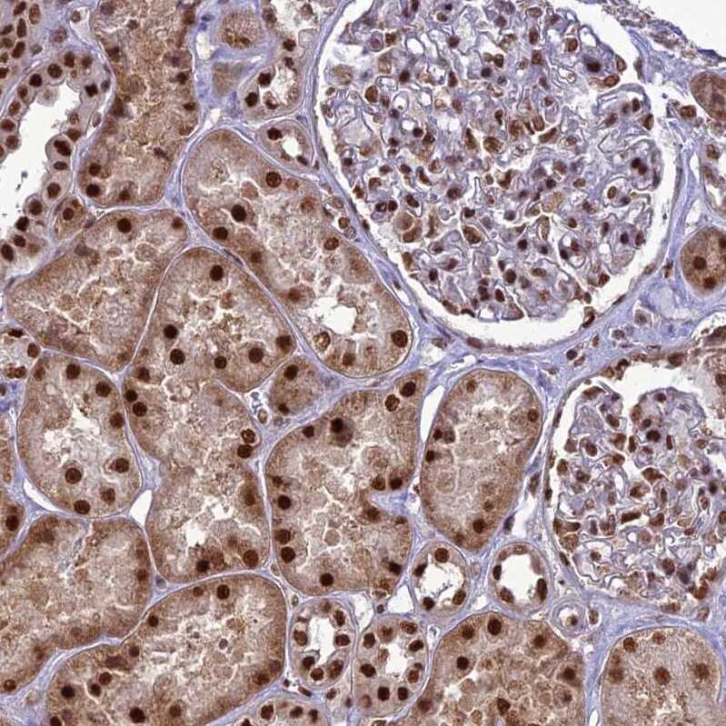 DDX1 Antibody - BSA Free Immunohistochemistry-Paraffin: DDX1 Antibody [NBP1-85293]