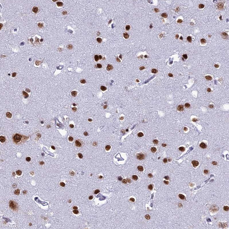 DDX1 Antibody - BSA Free Immunohistochemistry-Paraffin: DDX1 Antibody [NBP1-85293]