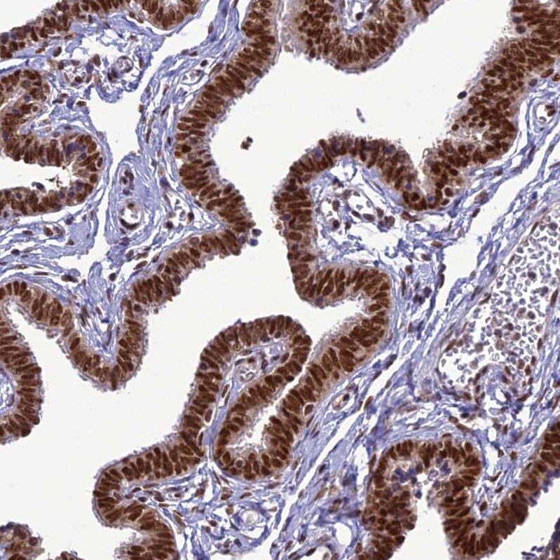 DDX1 Antibody - BSA Free Immunohistochemistry-Paraffin: DDX1 Antibody [NBP1-85293]