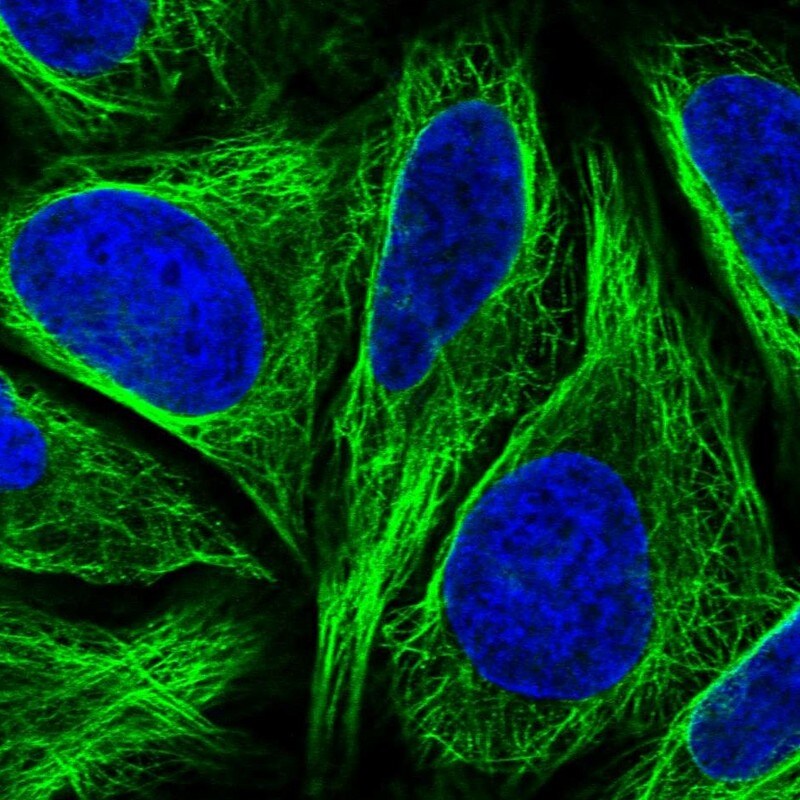 Dysbindin Antibody - BSA Free Immunocytochemistry/ Immunofluorescence: Dysbindin Antibody [NBP1-85300]