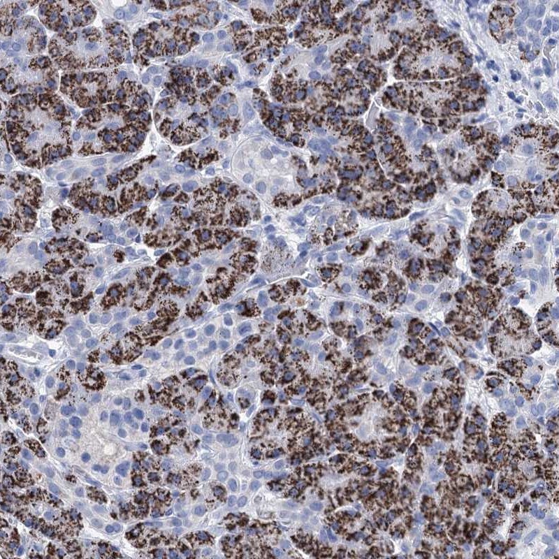 DBC1 Antibody - BSA Free Immunohistochemistry-Paraffin: DBC1 Antibody [NBP1-85303]