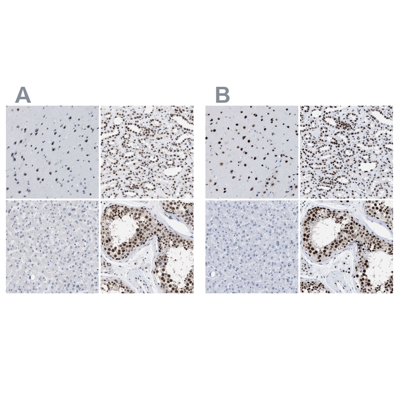 DBC1/p30 Antibody Immunohistochemistry-Paraffin: DBC1/p30 Antibody Antibody [NBP1-85305]