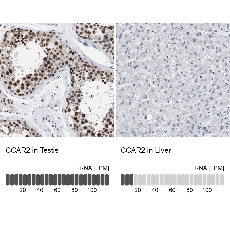 DBC1/p30 Antibody Immunohistochemistry-Paraffin: DBC1/p30 Antibody [NBP1-85305]