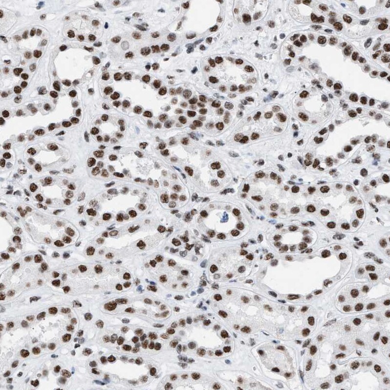 DBC1/p30 Antibody Immunohistochemistry-Paraffin: DBC1/p30 Antibody [NBP1-85305]