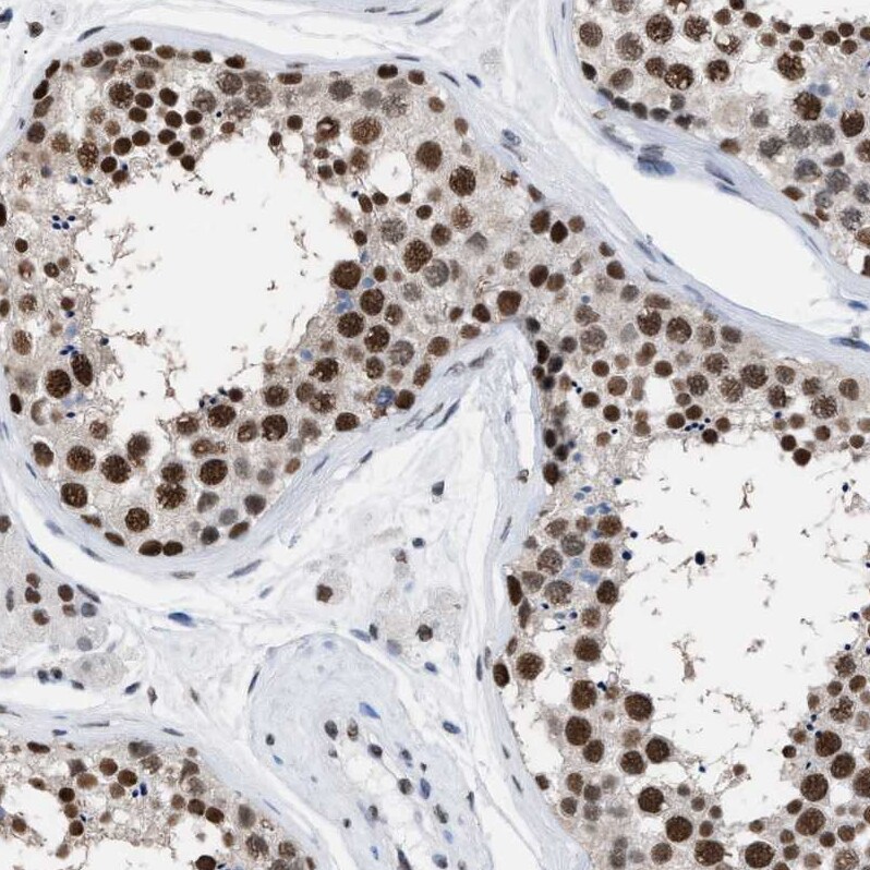 DBC1/p30 Antibody Immunohistochemistry-Paraffin: DBC1/p30 Antibody [NBP1-85305]