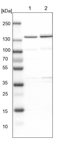 DBC1/p30 Antibody Western Blot: DBC1/p30 Antibody [NBP1-85305]