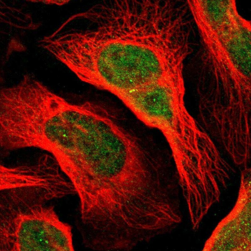 Dact1 Antibody - BSA Free Immunocytochemistry/ Immunofluorescence: Dact1 Antibody [NBP1-85308]