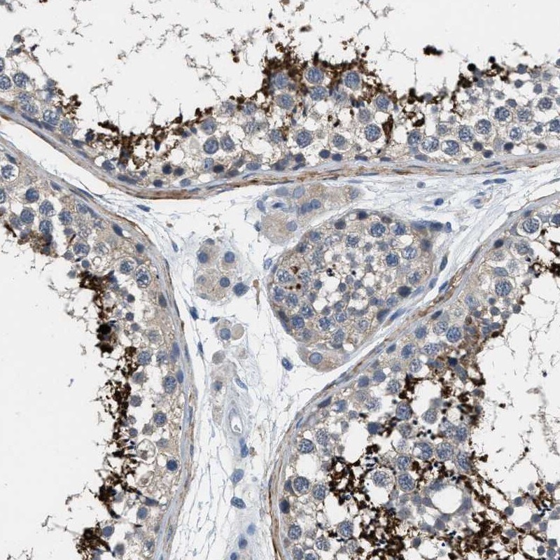 DGK-epsilon Antibody - BSA Free Immunohistochemistry-Paraffin: DGK-epsilon Antibody [NBP1-85315]