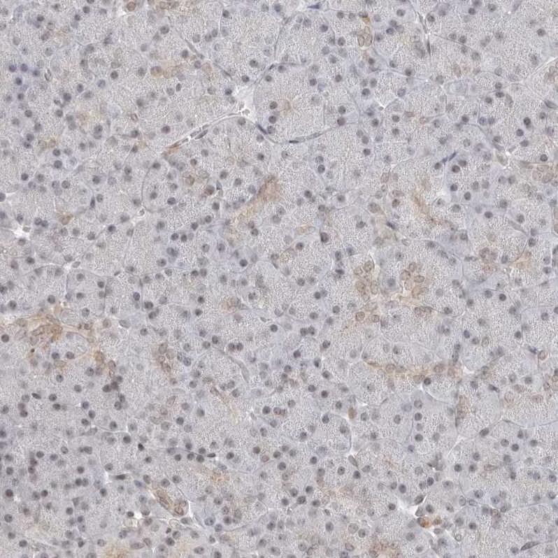 RNF146 Antibody Immunohistochemistry: RNF146 Antibody [RNF146 Antibody]