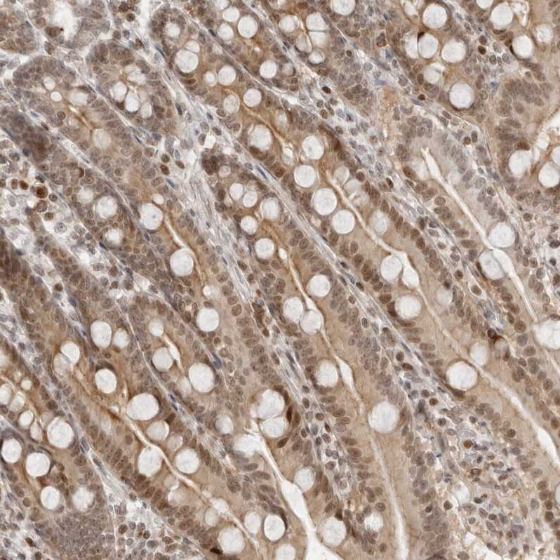 RNF146 Antibody Immunohistochemistry: RNF146 Antibody [RNF146 Antibody]