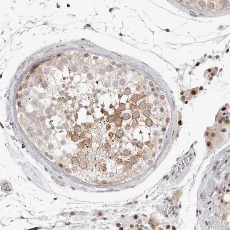 RNF146 Antibody Immunohistochemistry: RNF146 Antibody [RNF146 Antibody]