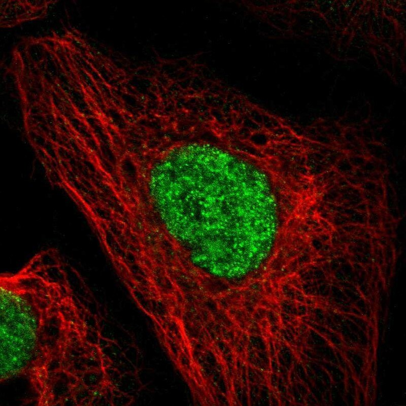 DACH1 Antibody - BSA Free Immunocytochemistry/ Immunofluorescence: DACH1 Antibody [NBP1-85320]