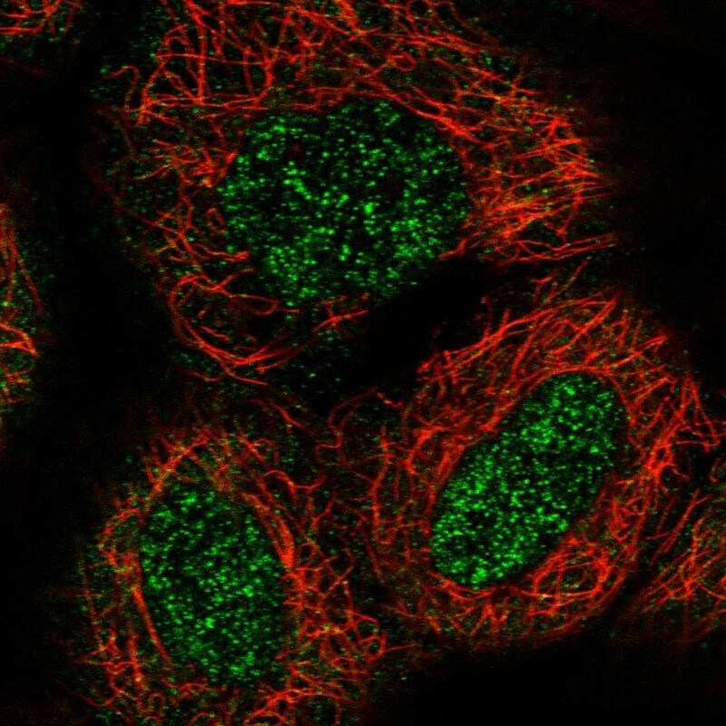 ZNF76 Antibody - BSA Free Immunocytochemistry/ Immunofluorescence: ZNF76 Antibody [NBP1-85323]