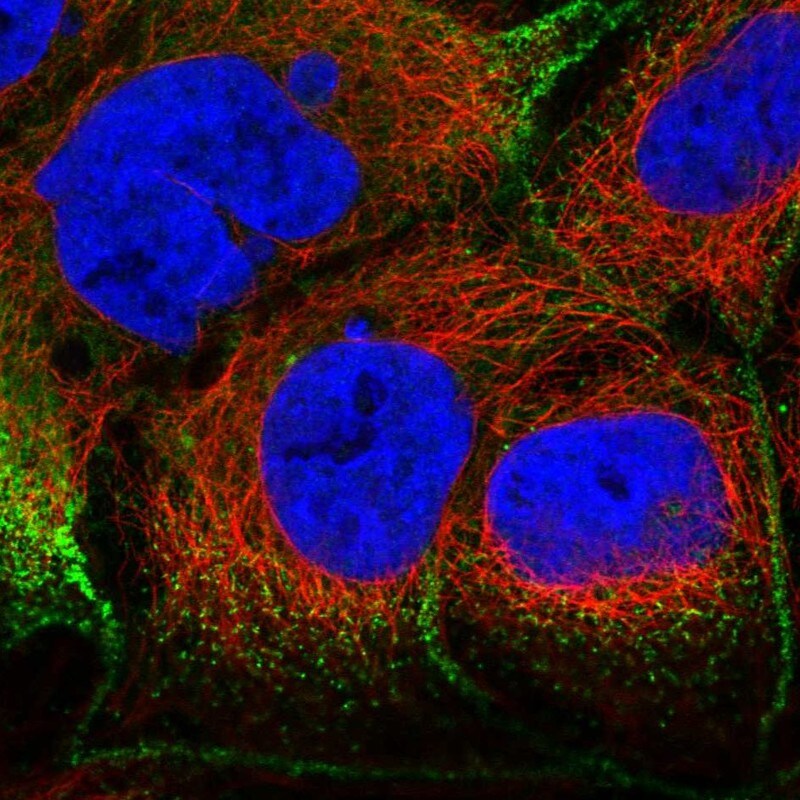Villin 1 Antibody - BSA Free Immunocytochemistry/ Immunofluorescence: Villin 1 Antibody [NBP1-85335]