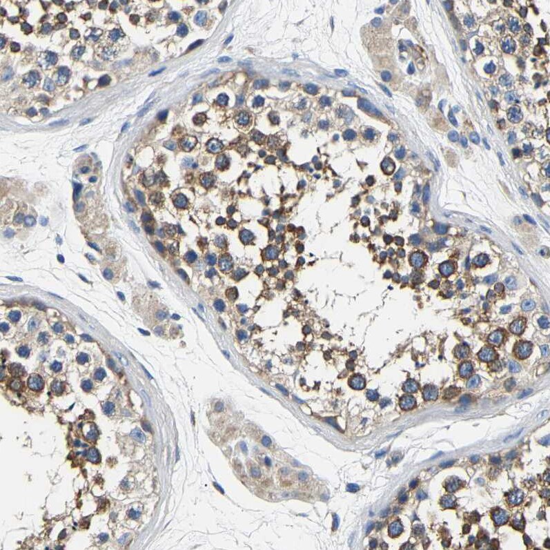 CSDE1 Antibody - BSA Free Immunohistochemistry-Paraffin: CSDE1 Antibody [NBP1-85341]