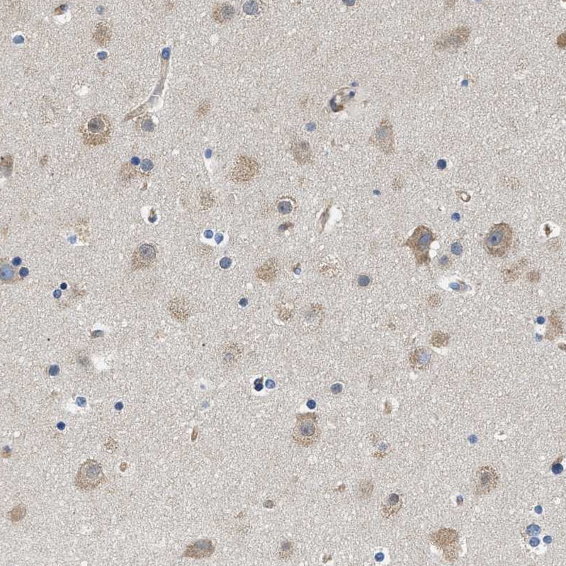CSDE1 Antibody - BSA Free Immunohistochemistry-Paraffin: CSDE1 Antibody [NBP1-85341]