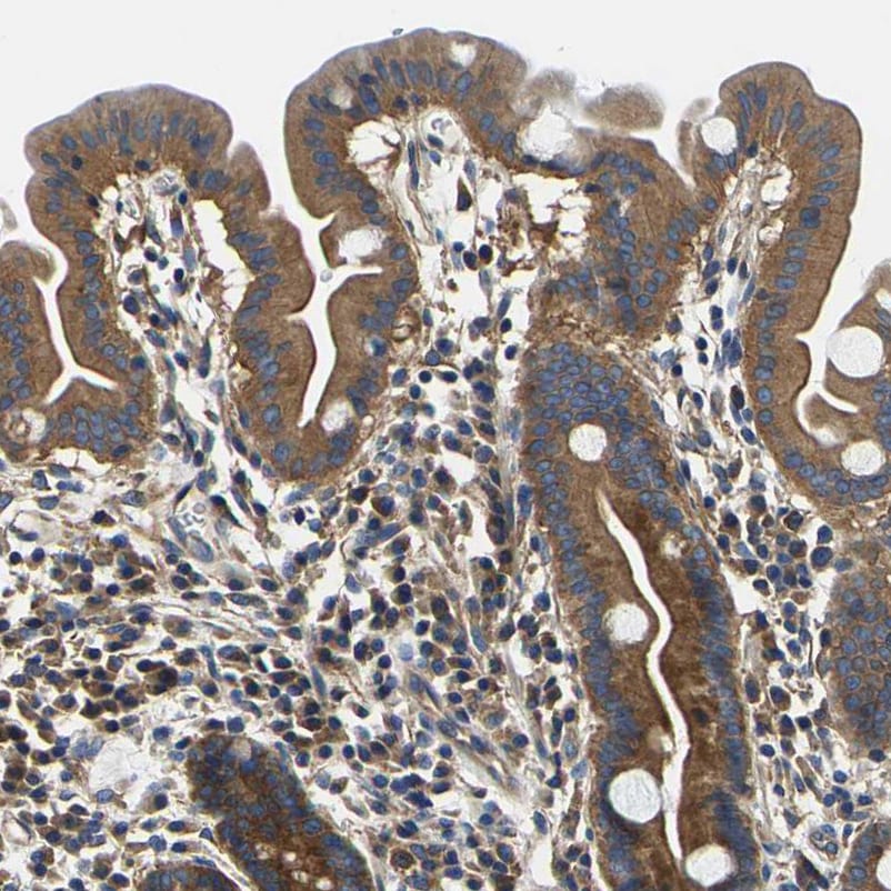 CSDE1 Antibody - BSA Free Immunohistochemistry-Paraffin: CSDE1 Antibody [NBP1-85341]