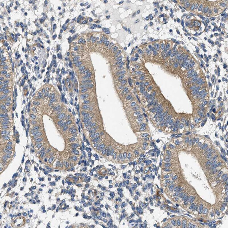 CSDE1 Antibody - BSA Free Immunohistochemistry-Paraffin: CSDE1 Antibody [NBP1-85341]