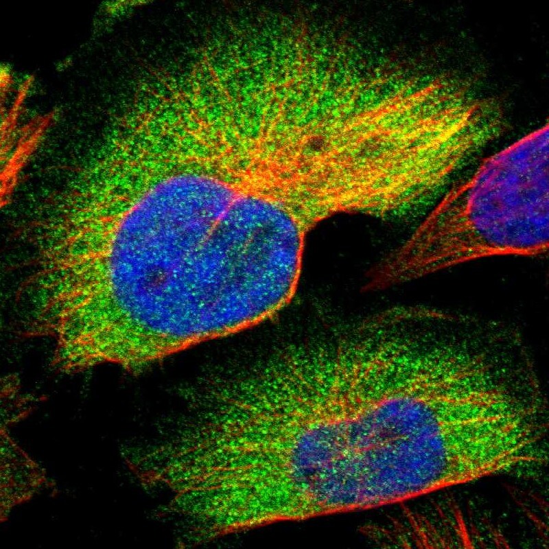 CCDC6 Antibody - BSA Free Immunocytochemistry/ Immunofluorescence: CCDC6 Antibody [NBP1-85351]