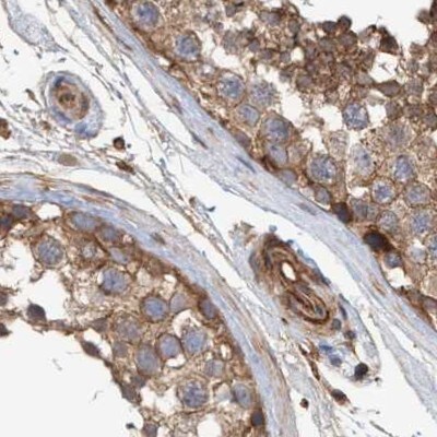 NSP 5 alpha 3 alpha Antibody - BSA Free Immunohistochemistry-Paraffin: NSP 5 alpha 3 alpha Antibody [NBP1-85352]