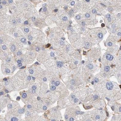 NSP 5 alpha 3 alpha Antibody - BSA Free Immunohistochemistry-Paraffin: NSP 5 alpha 3 alpha Antibody [NBP1-85352]