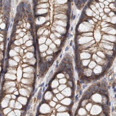 NSP 5 alpha 3 alpha Antibody - BSA Free Immunohistochemistry-Paraffin: NSP 5 alpha 3 alpha Antibody [NBP1-85352]