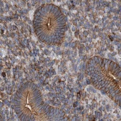 NSP 5 alpha 3 alpha Antibody - BSA Free Immunohistochemistry-Paraffin: NSP 5 alpha 3 alpha Antibody [NBP1-85352]