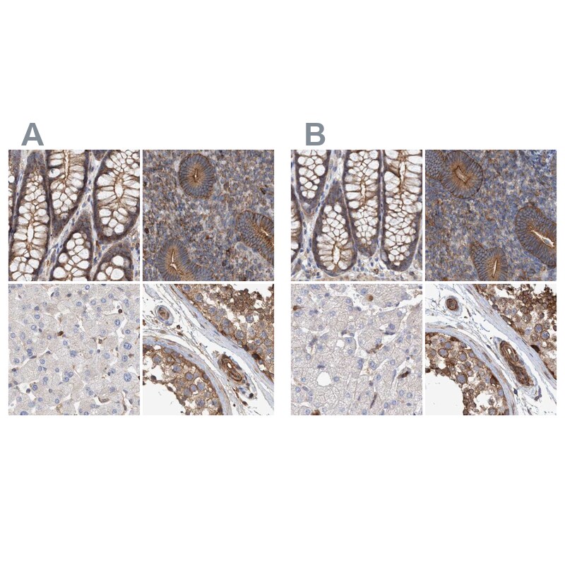 NSP 5 alpha 3 alpha Antibody - BSA Free Immunohistochemistry-Paraffin: NSP 5 alpha 3 alpha Antibody [NBP1-85352]