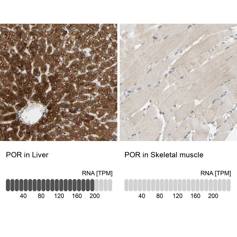 POR/Cytochrome P450 Reductase Antibody - BSA Free Immunohistochemistry-Paraffin: POR/Cytochrome P450 Reductase Antibody [NBP1-85357]