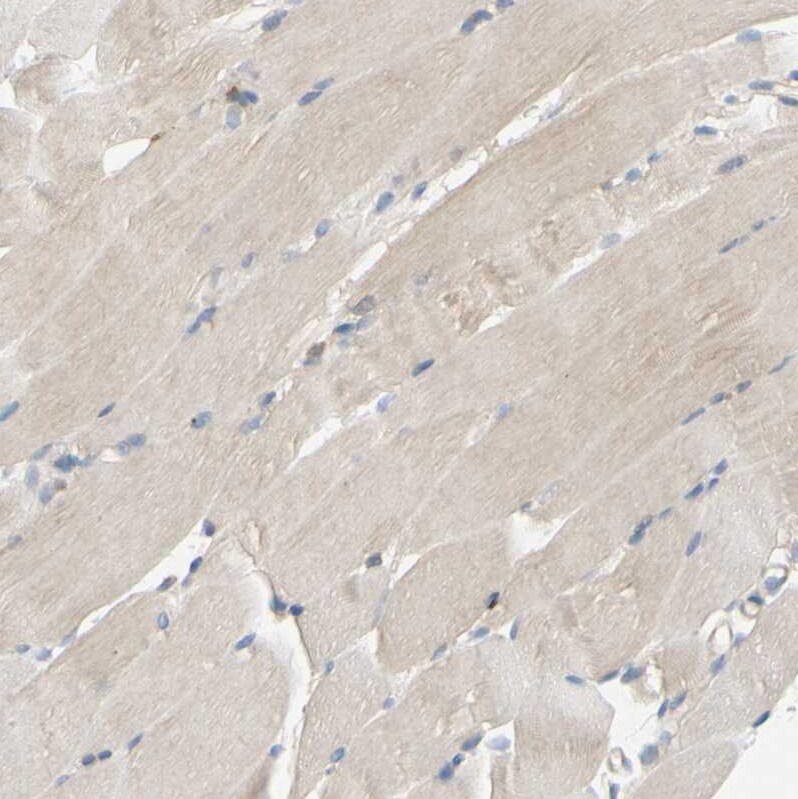 POR/Cytochrome P450 Reductase Antibody - BSA Free Immunohistochemistry-Paraffin: POR/Cytochrome P450 Reductase Antibody [NBP1-85357]