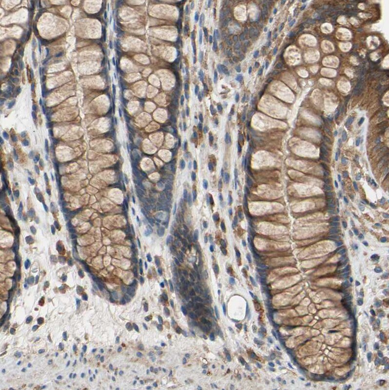 POR/Cytochrome P450 Reductase Antibody - BSA Free Immunohistochemistry-Paraffin: POR/Cytochrome P450 Reductase Antibody [NBP1-85357]