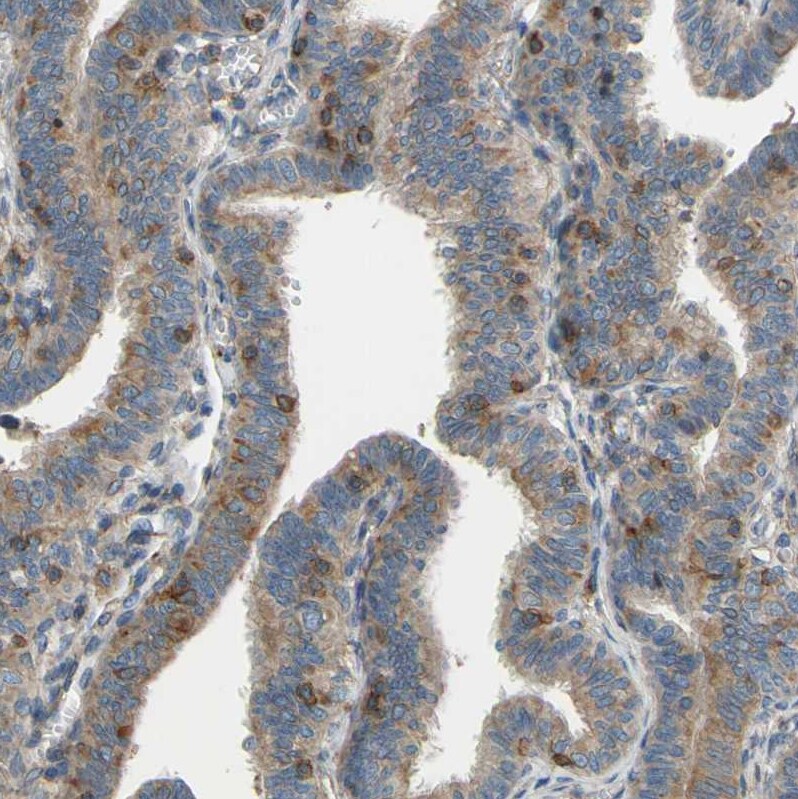 POR/Cytochrome P450 Reductase Antibody - BSA Free Immunohistochemistry-Paraffin: POR/Cytochrome P450 Reductase Antibody [NBP1-85357]