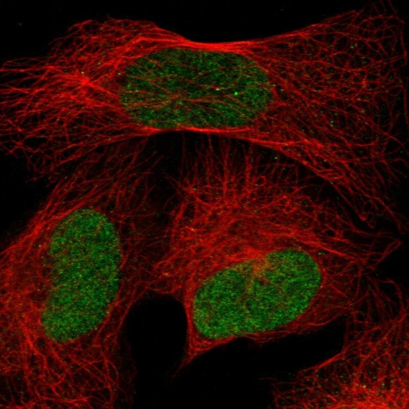 PPIL2 Antibody - BSA Free Immunocytochemistry/ Immunofluorescence: PPIL2 Antibody [NBP1-85360]