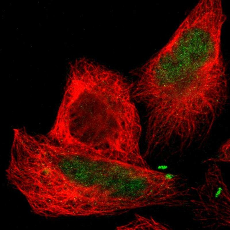 CTRP6 Antibody - BSA Free Immunocytochemistry/ Immunofluorescence: CTRP6 Antibody [NBP1-85381]