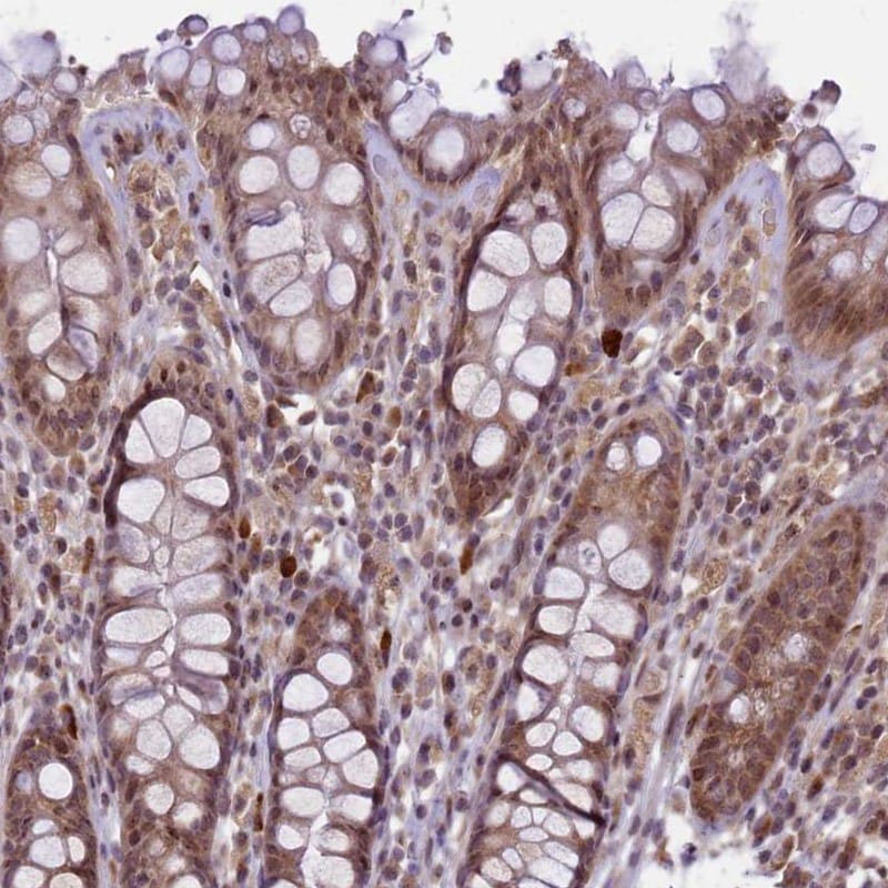 CtIP Antibody - BSA Free Immunohistochemistry: CtIP Antibody - BSA Free [NBP1-85384]