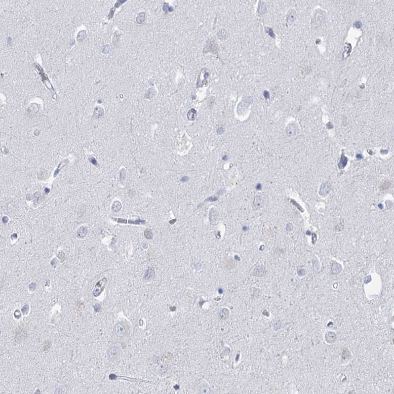 HORMAD1 Antibody - BSA Free Immunohistochemistry-Paraffin: HORMAD1 Antibody [NBP1-85401]
