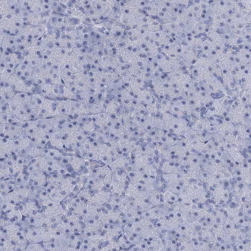 HORMAD1 Antibody - BSA Free Immunohistochemistry-Paraffin: HORMAD1 Antibody [NBP1-85401]