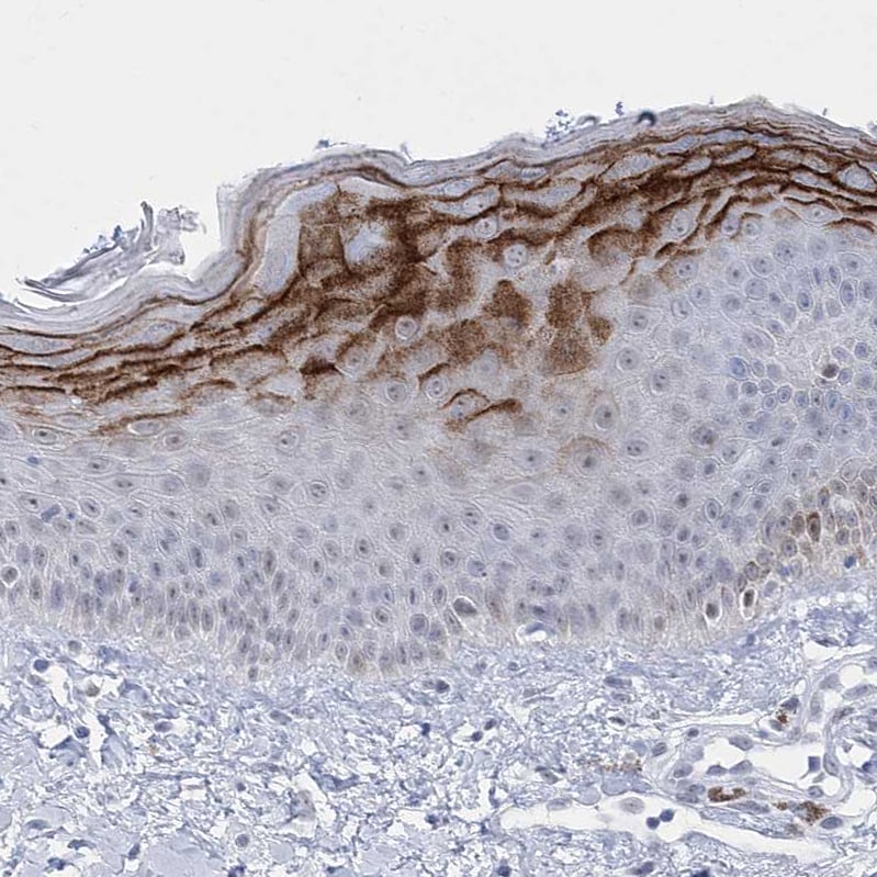 HORMAD1 Antibody - BSA Free Immunohistochemistry-Paraffin: HORMAD1 Antibody [NBP1-85401]