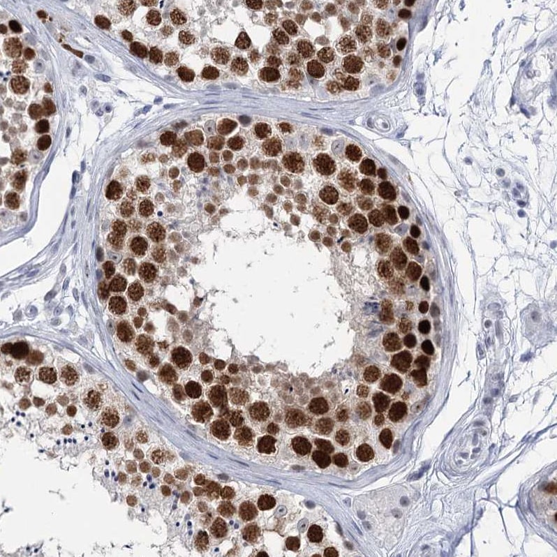 HORMAD1 Antibody - BSA Free Immunohistochemistry-Paraffin: HORMAD1 Antibody [NBP1-85401]