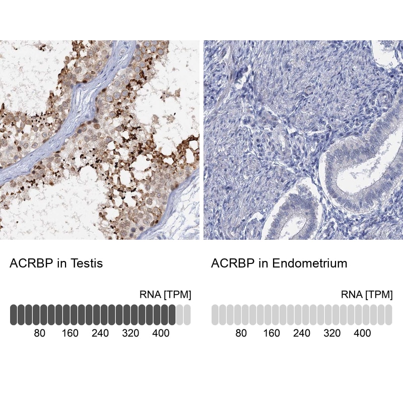 ACRBP Antibody - BSA Free Immunohistochemistry-Paraffin: ACRBP Antibody [NBP1-85408]