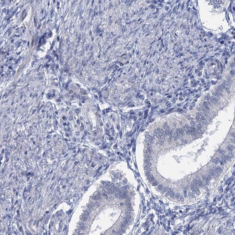 ACRBP Antibody - BSA Free Immunohistochemistry-Paraffin: ACRBP Antibody [NBP1-85408]
