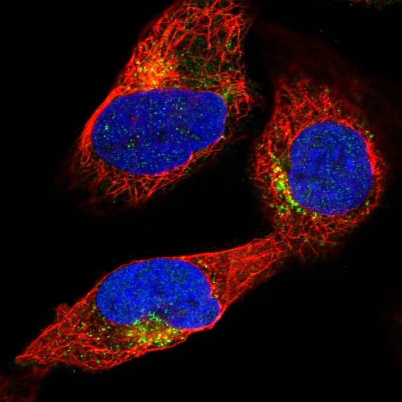SP17 Antibody - BSA Free Immunocytochemistry/ Immunofluorescence: SP17 Antibody [NBP1-85409]