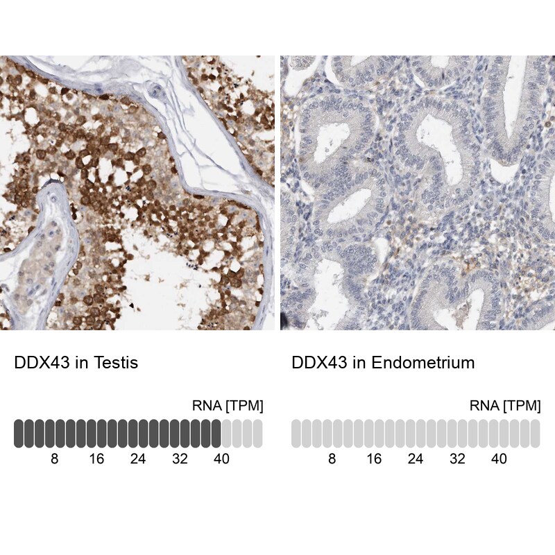 DDX43 Antibody - BSA Free Immunohistochemistry-Paraffin: DDX43 Antibody [NBP1-85419]