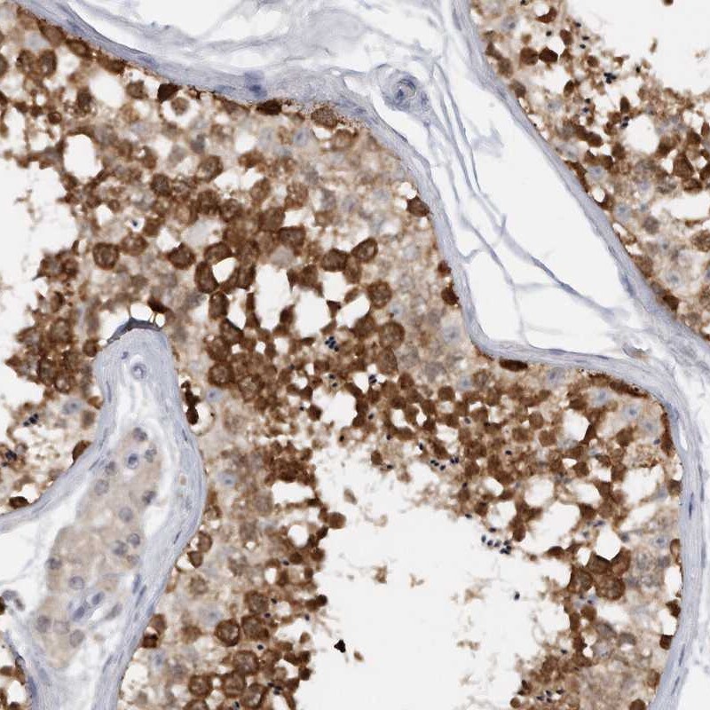 DDX43 Antibody - BSA Free Immunohistochemistry-Paraffin: DDX43 Antibody [NBP1-85419]